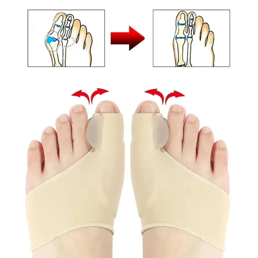 Bunion Relief Kit: Instant Comfort & Toe Protection
